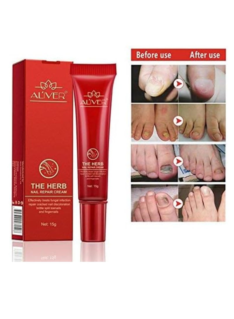 أليفر اليفر كريم علاج اظافر فطري ممتاز مضاد للفطريات ومضاد للفطريات لازالة فطريات الاظافر ويقتلها، مناسب لاظافر القدم والاظافر، فعال ضد 99.9% من فطريات الاظافر - Image 2