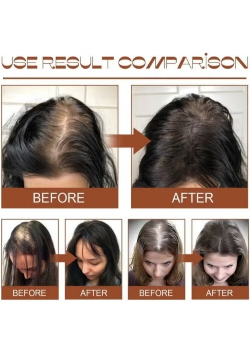 EELHOE Organic Batana Hair Growth Oil – Thicker Fuller Healthier Hair | Natural Repair & Nourishment - Image 4