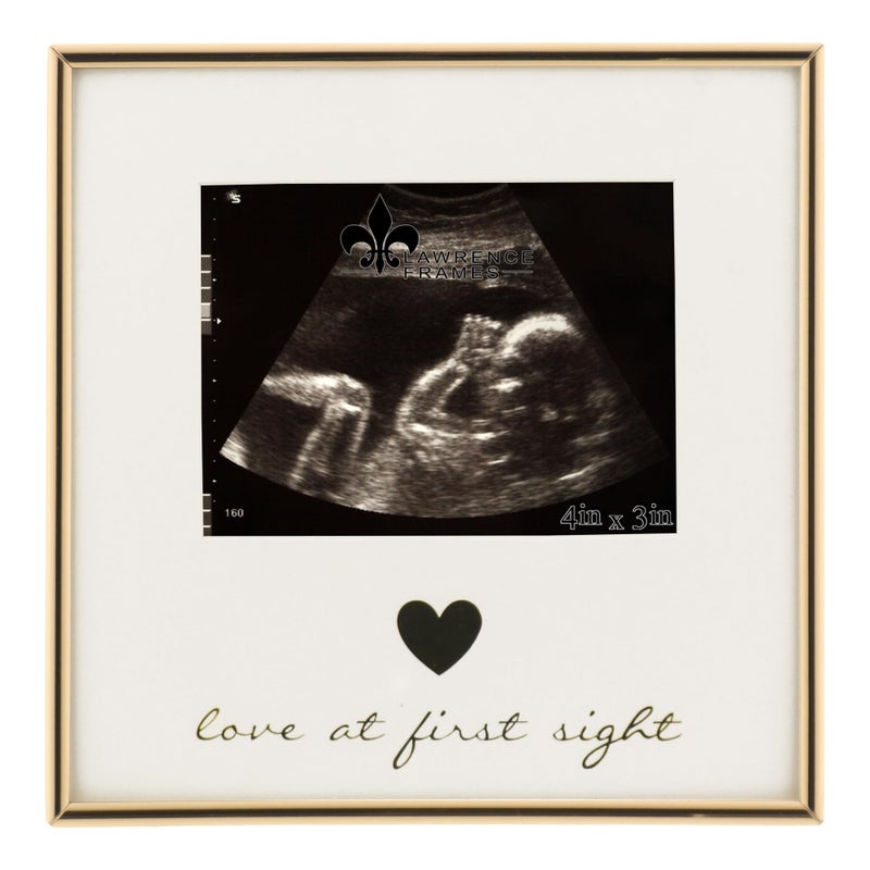 5x3 Sonogram - Ultrasound Gold Metla Picture Frame - Love at First Sight Design