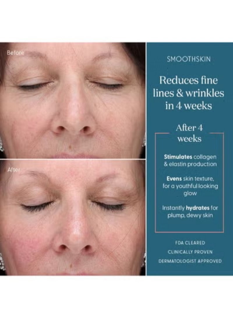 سموث سكن  قناع الوجه SmoothSkin DuoLux العلاجي بالضوء الأحمر LED ومجموعة العناية بالبشرة المرطبة مع 15 قناعًا من أوراق الهيدروجيل. - Image 5