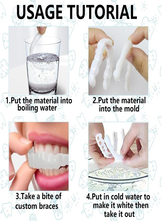 SQUISHCO 2 Pairs Teeth Caps for Women, Comfortable Flex Fit Dentures for Top & Bottom,Snap On Dental Teeth Covers with Storage Boxes for Neat Smile - Image 5