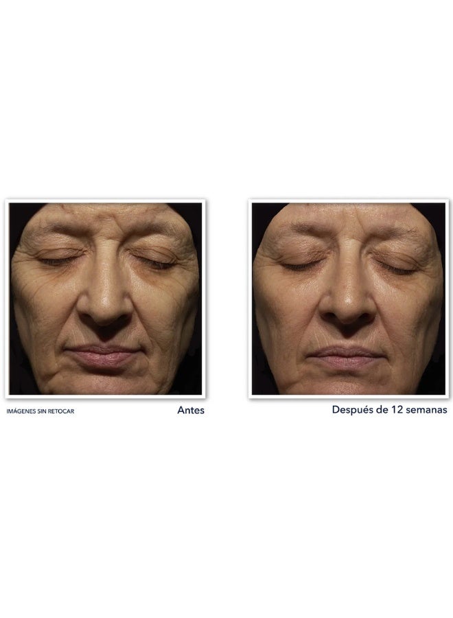 روك كريم روك ريتينول كوريكسون لتنعيم خطوط العين، ريتينول متقدم، 15 مل - Image 2