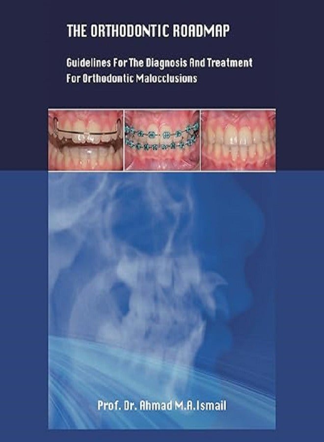 The Orthodontic Roadmap Guidelines For The Diagnosis And Treatment Of Orthodontic Malocclusions 