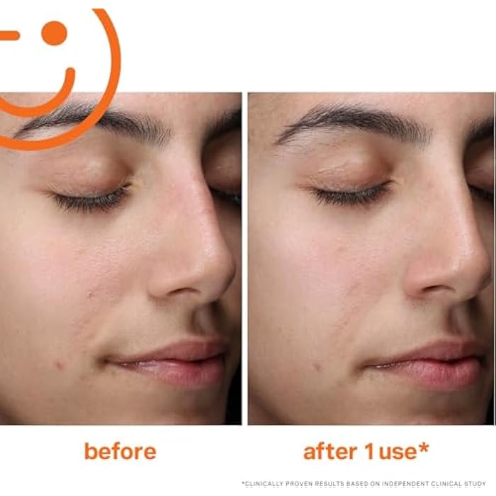 Kate Somerville ExfoliKate Cleanser – Daily Exfoliating Foaming Face Wash – Clinically Formulated Glycolic Acid and Lactic Acid Gentle Facial Scrub - Image 5