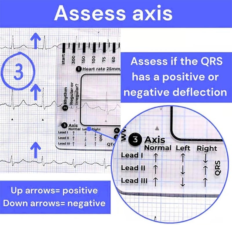 معدات تحليل تخطيط القلب 7 خطوات مسطرة بطاقة لقراءة بيانات القلب ملونة D - Image 4