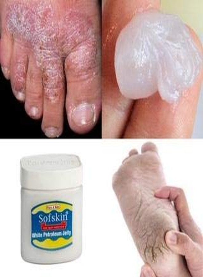 SOFSKIN (American Brand) Pure White Petroleum Jelly IP, pH 5.5 No skin alllergy, 100g - No Smell - Exp. 5 yrs. - Pack of 3 - Image 2