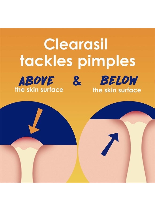 Clearasil Stubborn Acne Control 5in1 Spot Treatment Cream, Maximum Strenght with 10% Benzoyl Peroxide, Acne Medication, 1 oz - Image 3