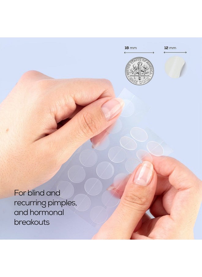 HANHOO - Soothing Blemish Patch Extra Strength Blemish Patch And Tzone Pore Patch Bundle Pimple Patches For Stubborn And Irritated Blemishes And Oily Tzone 88 Total Hydrocolloid Patches - Image 1