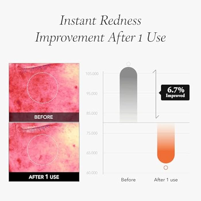 APRILSKIN Carrotene IPMP™ Instant Calming Serum Toner Pads | 5-Minute Cooling Serum Pads | Vegan, Cruelty-Free | Non-comedogenic | Toner-Serum-Sheet Mask All-in-one | Korean Skin Care, 80 Pads - Image 4