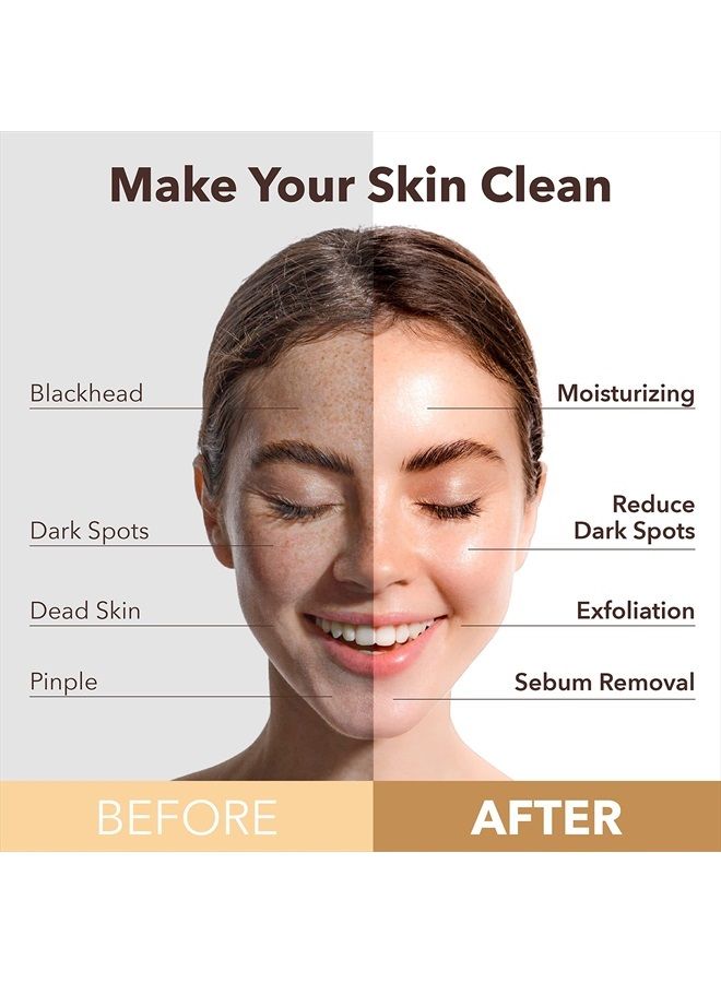 Purederm Green Tea Facial Mask Skin Care (5 Pack) - Bubble Face Sheet Mask for Moisturizing and Hydrating - Rich Collagen and Botanical Extracts Soothe and Illuminate Your Skin - Korean Beauty Skin Ma - Image 3