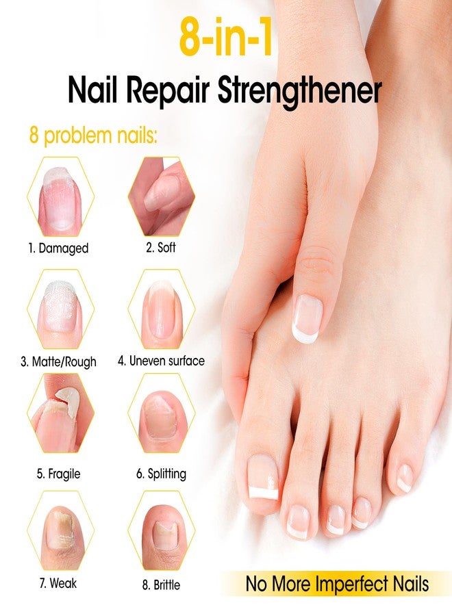 Gellen Pro Care Nail Strengthener, Ginger Serum Treatment, 8-IN-1 Air Dry Clear Nail Repair Growth Strengthener Calcium Keratin Nourish for Thin Damaged Nails Growth & Post-Removal Repair - Image 3