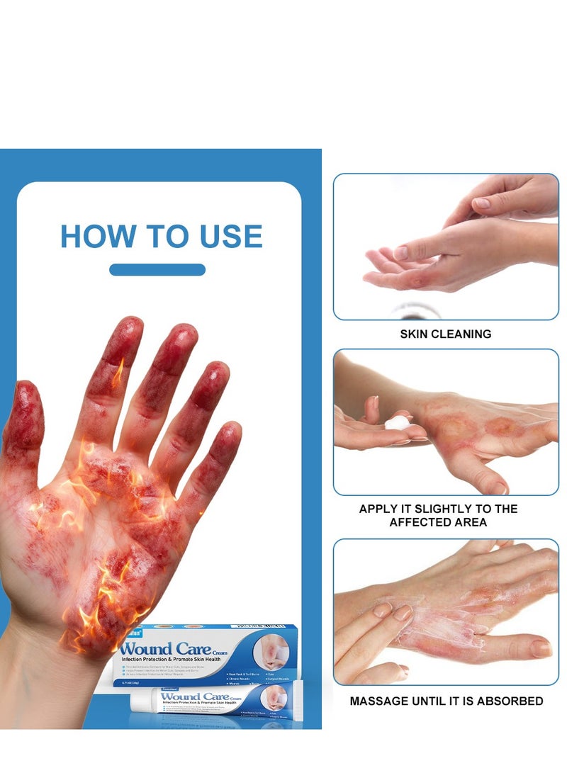 سوميفون كريم العناية بالجروح 20 جم ، مرهم لتخفيف الحروق للتهدئة والتبريد ، مثالي لعلاج الحروق والحروق ، يمنع العدوى ، يحمي صحة الجلد ، يخفض درجة حرارة الجلد لوقف تطور الحروق - Image 5