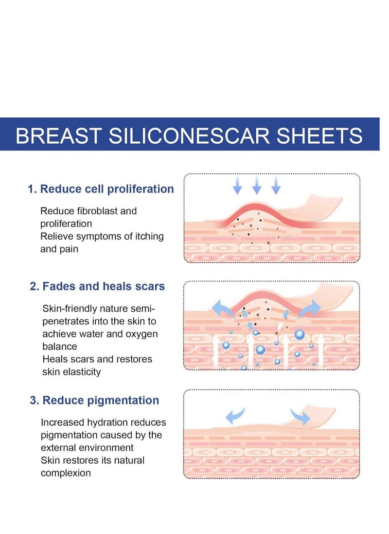 Silicone Scar Sheets, Reusable Washable Silicone Scar Tape, Surgery Scars Removal Treatment, Medical Grade Silicone Scar Sheets for Breast 4Pairs
