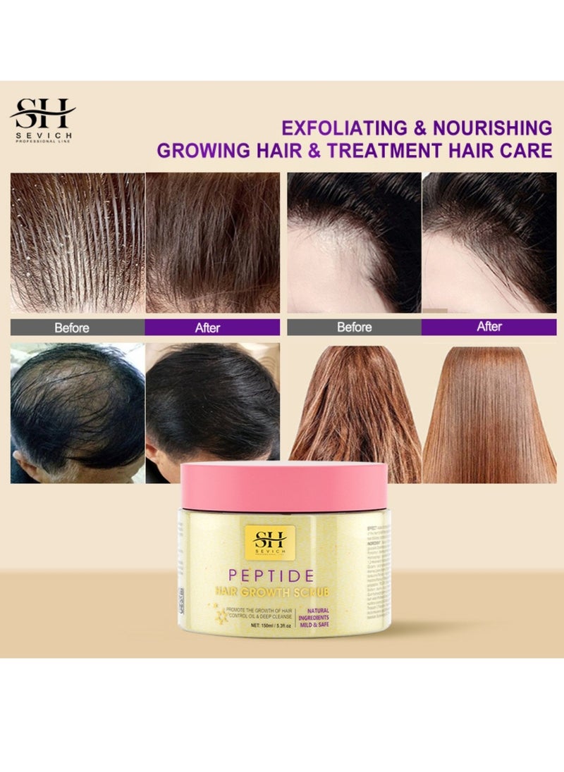Sevich - 150ml Peptide Hair Growth Scrub Promote Hair Growth Control Oil and Deep Cleanse Scalp Natural Ingredient Mild and Safe Repair Damaged Cortex Regrow Scalp Hair Follicles and Cleanses - Image 1