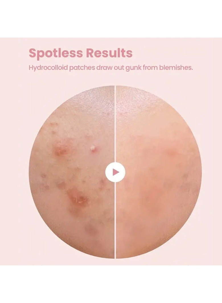 اكني باتش 144 قطعة من لاصقات البثور، ملصقات تغطية حب الشباب للوجه والبشرة، للعناية اليومية بالبشرة للرجال والنساء - Image 3