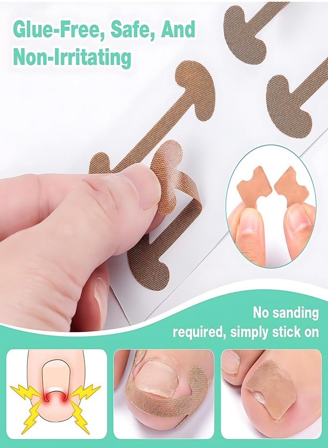 Aeenioy Ingrown Toe Nail Remover, Toe Nail Corrector Kit for Men and Seniors, Professional Ingrown Toenail Correction Tool, Home Foot Care Solution for Daily Nail Maintenance - Image 3
