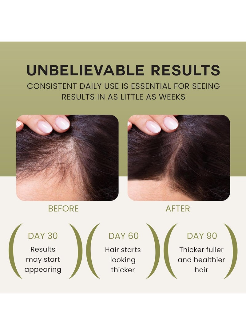 Wonder Batana Oil For Hair Growth - 100% Pure, Raw & Natural Blend With Organic Castor, Pumpkin Seed, Coconut and Rosemary Oil - Thicker, Stronger Hair For Men & Women Scalp (1 Pack) - Image 3