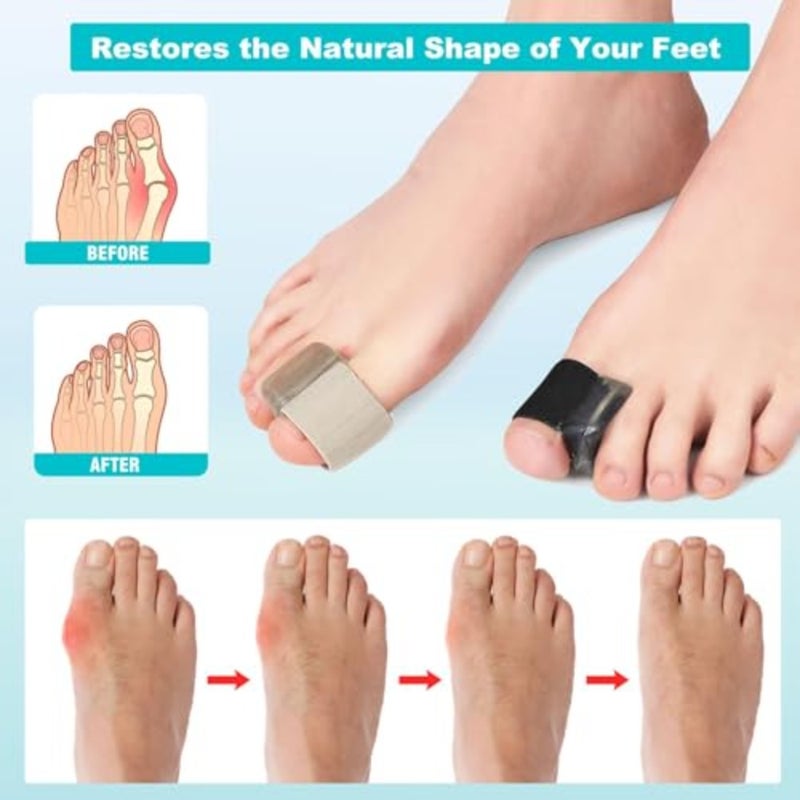 Toe Spacers Separators For Big Toe, Bunion Toe Separators For Overlapping Toes Women Men, Toe Spacers For Overlapping Toes and Bunion Pain Relief, Corrector And Spacer 8 Pack, L - Image 3