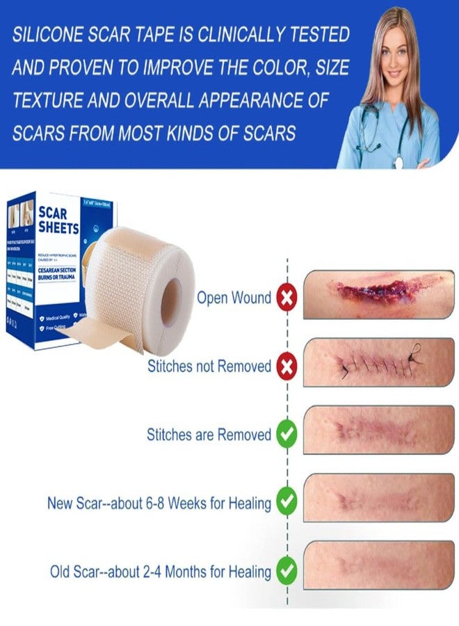 GoLashFun Silicone Scar Tape, Medical Grade Reusable Silicone Scar Tape, Scar Removal for Surgery, C-Section, Burns, Blemish and Birthmarks Etc(1.6’’x60’’ Roll-1.5M - Image 3