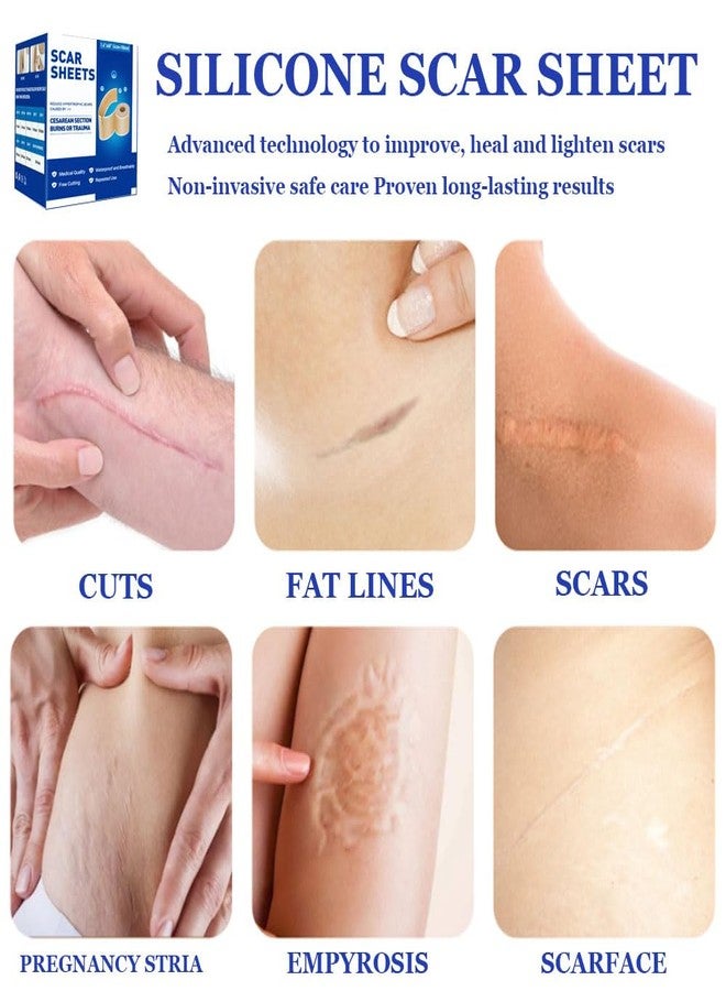 GoLashFun Silicone Scar Tape, Medical Grade Reusable Silicone Scar Tape, Scar Removal for Surgery, C-Section, Burns, Blemish and Birthmarks Etc(1.6’’x60’’ Roll-1.5M - Image 2