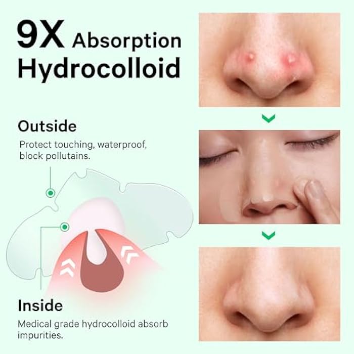 Sosky Patches for Nose, Hydrocolloid Pimple & Pore Nose Patches, Absorbs Oil Overnight Nose Pore Strips, Targets Pimples, Zits and Pores, FSA Eligible Acne Patches, Clear Skin 14 Count - Image 4
