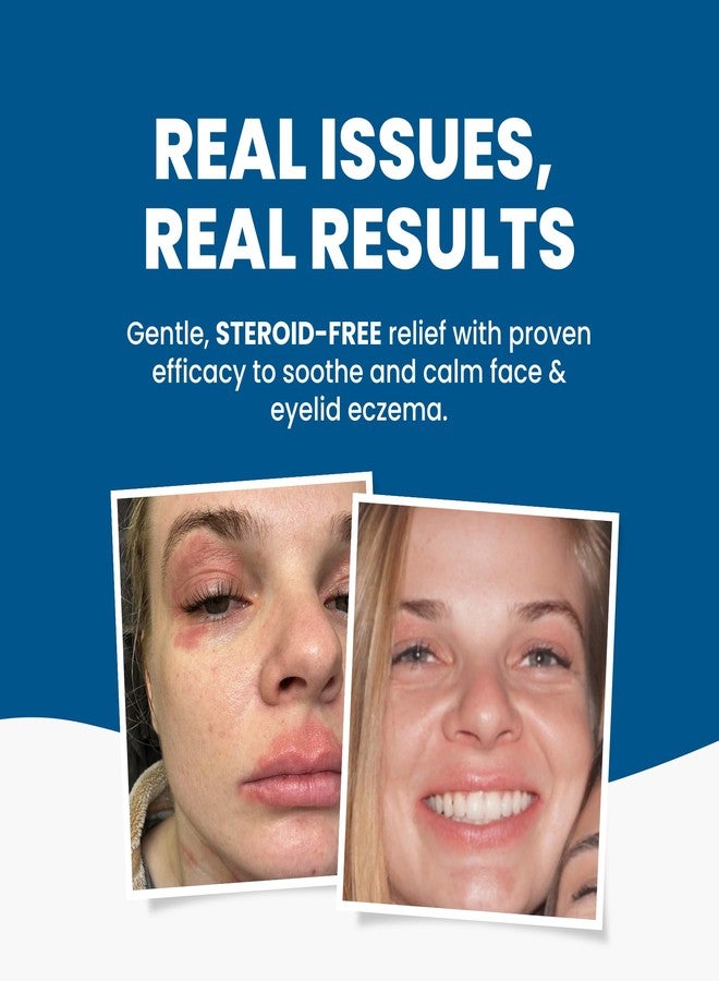 Grahams Natural زيت الوجه والجفن الطبيعي من غراهام - للبشرة الجافة جداً حول العين والوجه، الإكزيما والتهاب الجلد حول الفم - خالي من الستيرويدات، مضاد للحساسية، غير كوميدوغينيك - مع زيت الأركان وزيت الجوجوبا (1 × 1.69 أونصة سائلة)  - Image 2