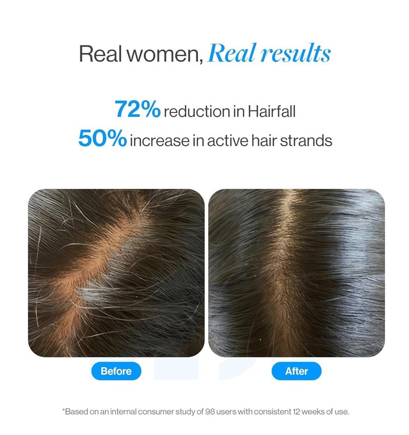 Be Bodywise Rosemary Hair Growth Serum Roll On 10ml | 3% Redensyl & 2% Anagain | Supports Hair Growth & Hair Strength | For All Hair Types - Image 3