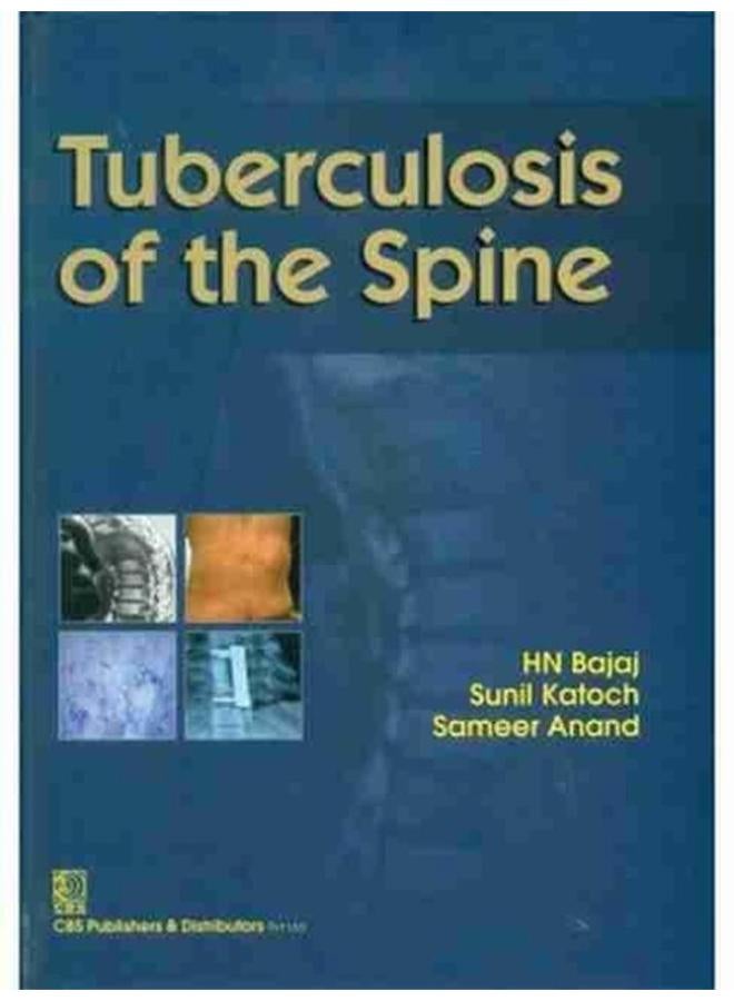Tuberculosis of the Spine