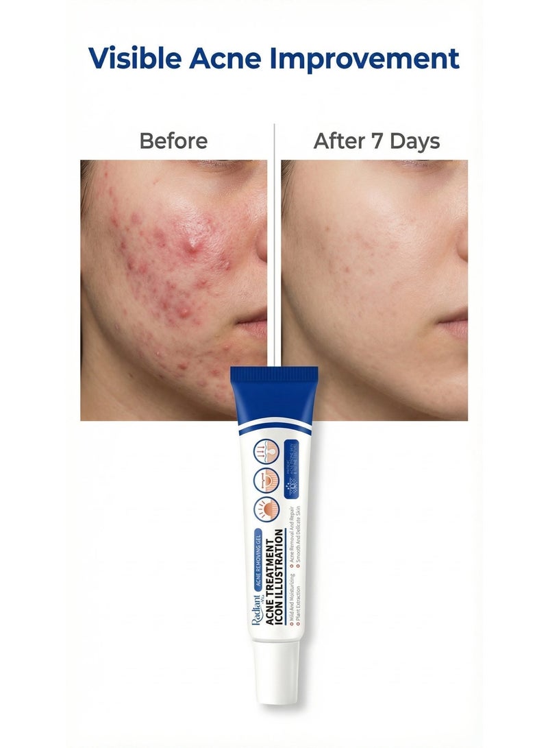 Radiant Acne Treatment Cream Anti Acne Gel Moisturizing For Oily And Acne Prone Skin - Image 2