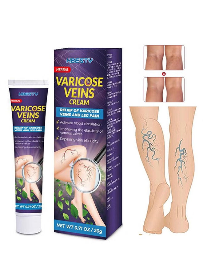 HBESTY Varicose Veins Cream Relief Phlebitis Angiitis 100% Natural Ingredients Added Eliminate the Appearance of Varicose Veins - Vein Inflammation Treatment for Men & Women 20g - Image 1