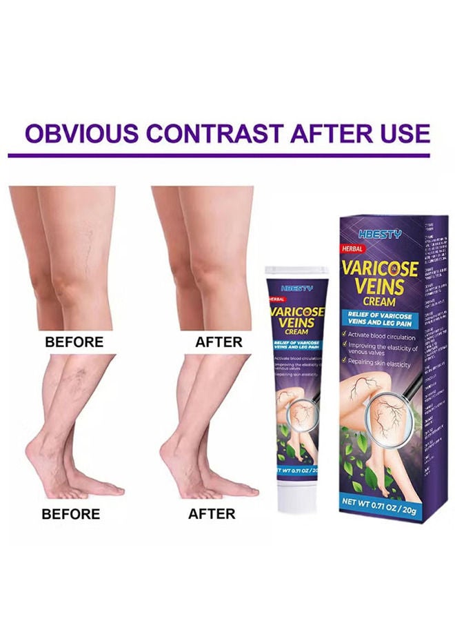 HBESTY Varicose Veins Cream Relief Phlebitis Angiitis 100% Natural Ingredients Added Eliminate the Appearance of Varicose Veins - Vein Inflammation Treatment for Men & Women 20g - Image 3