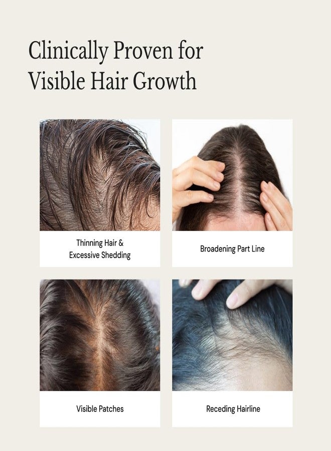 ريتشفيل سيروم ريتشفيل أناغرو® المتطور لإعادة نمو الشعر - تركيبة سويسرية • يتحكم في تساقط الشعر • يحفز إعادة النمو • يزيد الكثافة • تركيبة خفيفة الوزن (2 × 15 مل) - Image 2