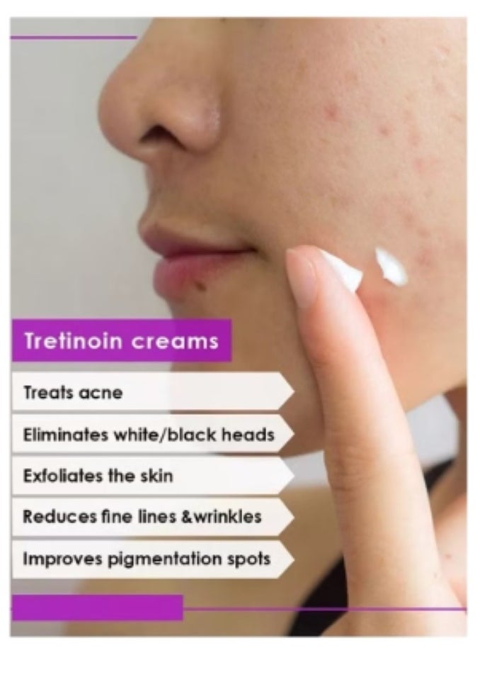 Jamjoom Medical solution Skin Care Set for the Optimal and Ultimate Treatment for Acne and Skin Problems(Acretin 0.05% Acne Cream 30 gm + Hi Quin Pro Whitening Exfoliating Acne Treatment 4% Cream 30 gm + Acretin 0.025% Cream 30 gm)  - Image 4