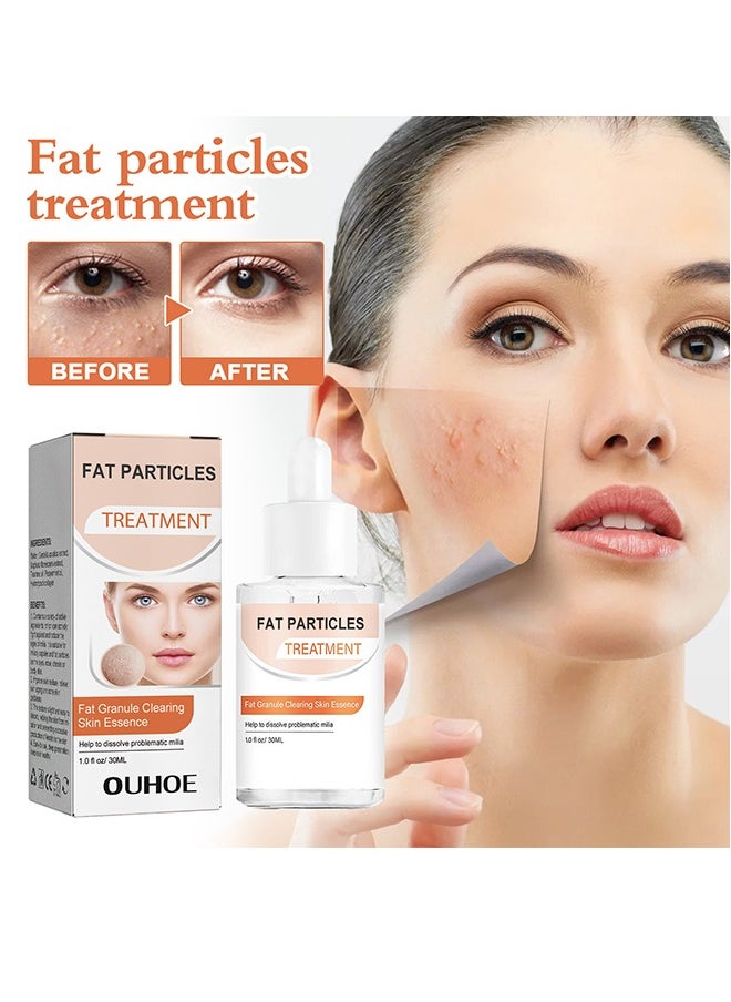 OUHOE - Fat Particles Treatment-Fat Granule Clearing Skin Essense，Fat Granules Removal Eye Serum, Natural Formula Milia Remover Milia Spot Treatment, Anti Dark Circle Fade Fine Essence, Anti Puffiness Moisturizing Skin Care Serum - Image 1