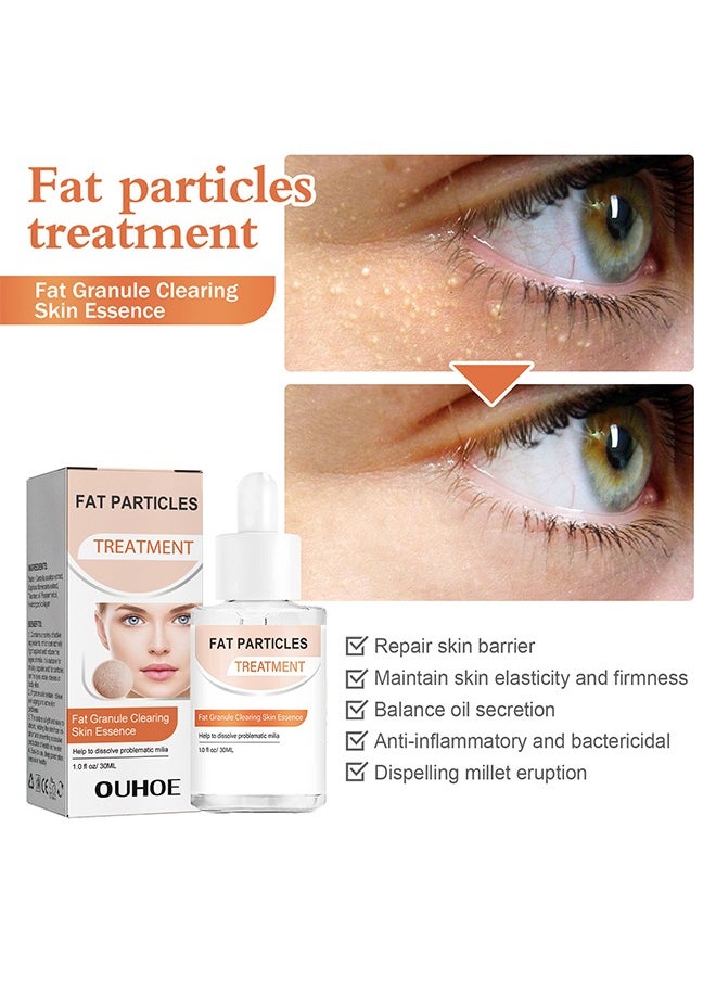 OUHOE - Fat Particles Treatment-Fat Granule Clearing Skin Essense，Fat Granules Removal Eye Serum, Natural Formula Milia Remover Milia Spot Treatment, Anti Dark Circle Fade Fine Essence, Anti Puffiness Moisturizing Skin Care Serum - Image 1