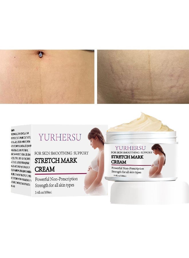 YURHERSU كريم علامات التمدد للحمل | كريم مرطب وملطف للجسم | يقلل من ظهور الندوب وعلامات التمدد | العناية ببشرة البطن قبل وبعد الولادة | مناسب للتدليك | 100 مل - Image 1