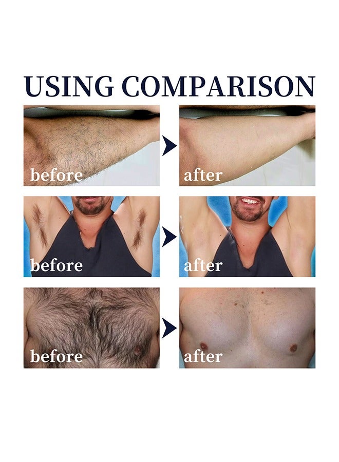إيست مون رغوة بخاخ إزالة الشعر ، بخاخ إزالة الشعر غير المؤلم بخاخ الإبط مزيل الشعر اللطيف بخاخ إزالة الشعر السريع المنعش ، مزيل الشعر الآمن للرجال تحت الإبط والصدر والظهر والساقين - 100 مل - Image 5