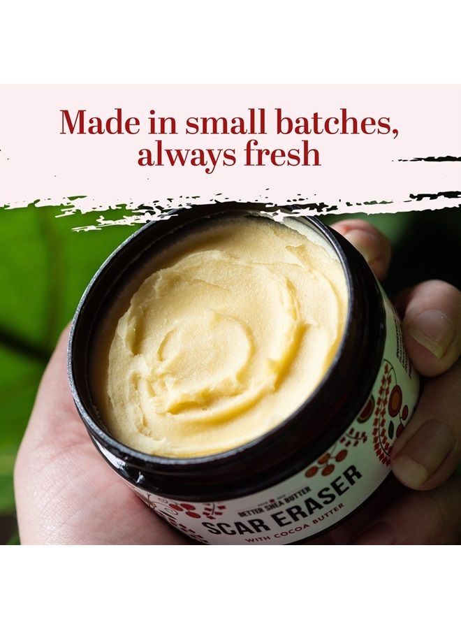 كريم إزالة الندوب | لعلامات التمدد، ندوب حب الشباب، الحروق، الندوب القديمة | مصمم بدون مكونات صناعية أو مواد حافظة (4 أونصات)