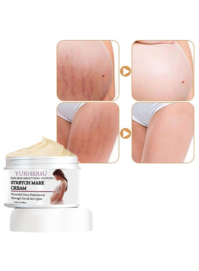 YURHERSU كريم علامات التمدد ، كريم الوقاية من علامات التمدد للحمل ، مزيل كريم علامات التمدد ، كريم علامات التمدد لتدليك الجسم ، يقلل من ظهور الندبات ، العناية ببشرة البطن قبل الولادة وبعدها 100 مل - Image 3