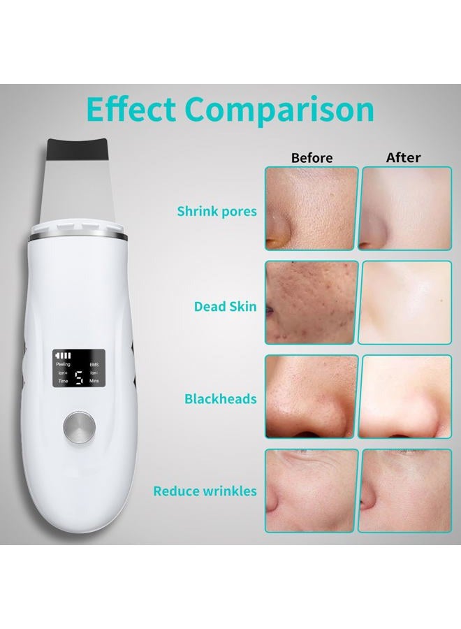 QYCSL Skin Scrubber Face Spatula - 4-in-1 Deep Cleansing Tool for Pore Extraction, Fast Charging Dock Blackhead Remover Face Spatula for Facial Skincare Women Gift (White) - Image 3