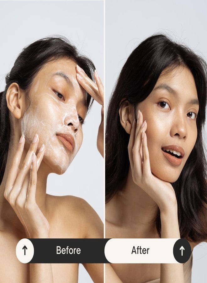 QUAT Reduces Inflammation Balances Sebum Fades Acne Scars Cream (50 g) - Image 4
