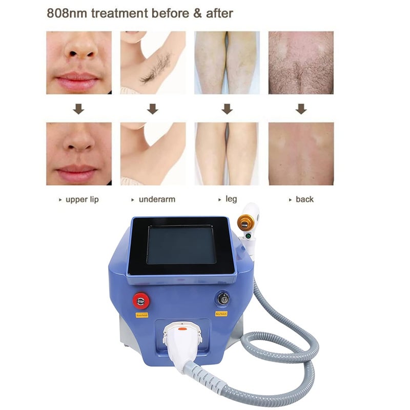 klarako Hair Removal Machine, Portable 808 Diode Laser Hair Removal Machine, Designed for Beauty Salon (3 wavelengths: 755nm/ 808nm/ 1064nm) - Image 2