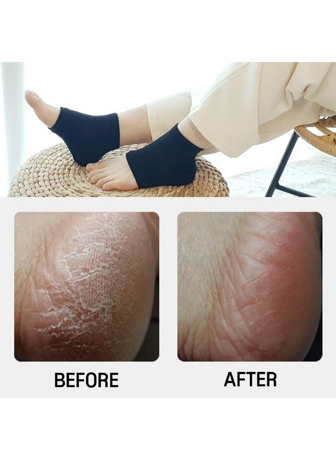FOOTINSOLE.COM - Moisturizing Gel Heel Socks To Repair Dry Cracked Heel - Soften, Soothe, And Revitalize Your Feet, For Men And Women (Black, 1 Pair) - Image 1