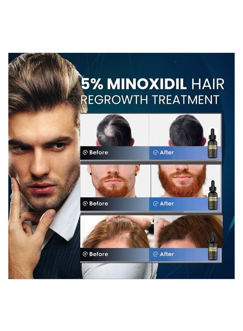 LUNOON 5% Minoxidil Hair Growth Serum for Men With Biotin & Panthenol, Men Beard Growth with Biotin and Minoxidil Extract Serum for Hair Loss, Thinning and Faster Regrowth Treatment - Image 4