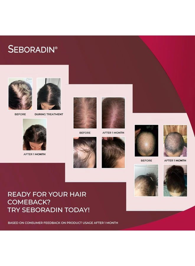 Seboradin Forte Hair Growth Serum, Anti Hair Loss Serum, Chronic Hair Loss and Thinning Treatment, With Natural Extracts and Vitamins, (14 Ampoules - 14 days) - Image 3