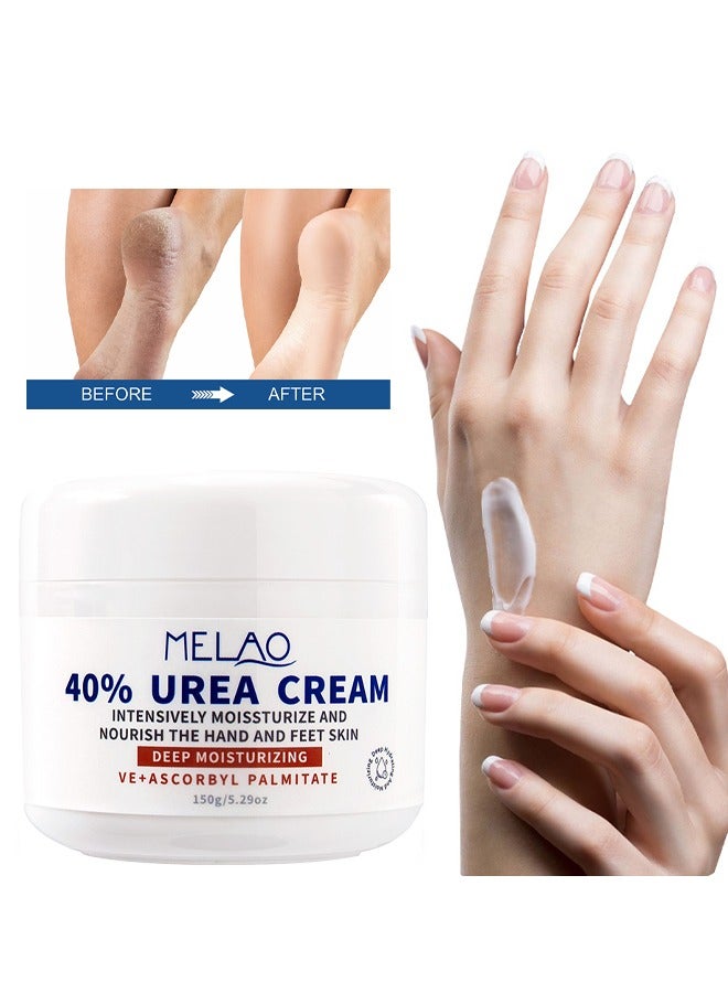 40% Urea Cream - Intensive Moisturizes and Nourish the Hand and Feet Skin,Softens Skin Callus  for Dry Cracked Heels Elbows 150g