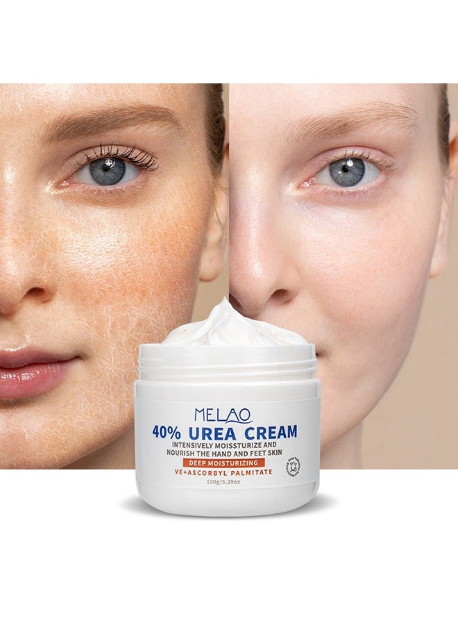 40% Urea Cream - Intensive Moisturizes and Nourish the Hand and Feet Skin,Softens Skin Callus  for Dry Cracked Heels Elbows 150g