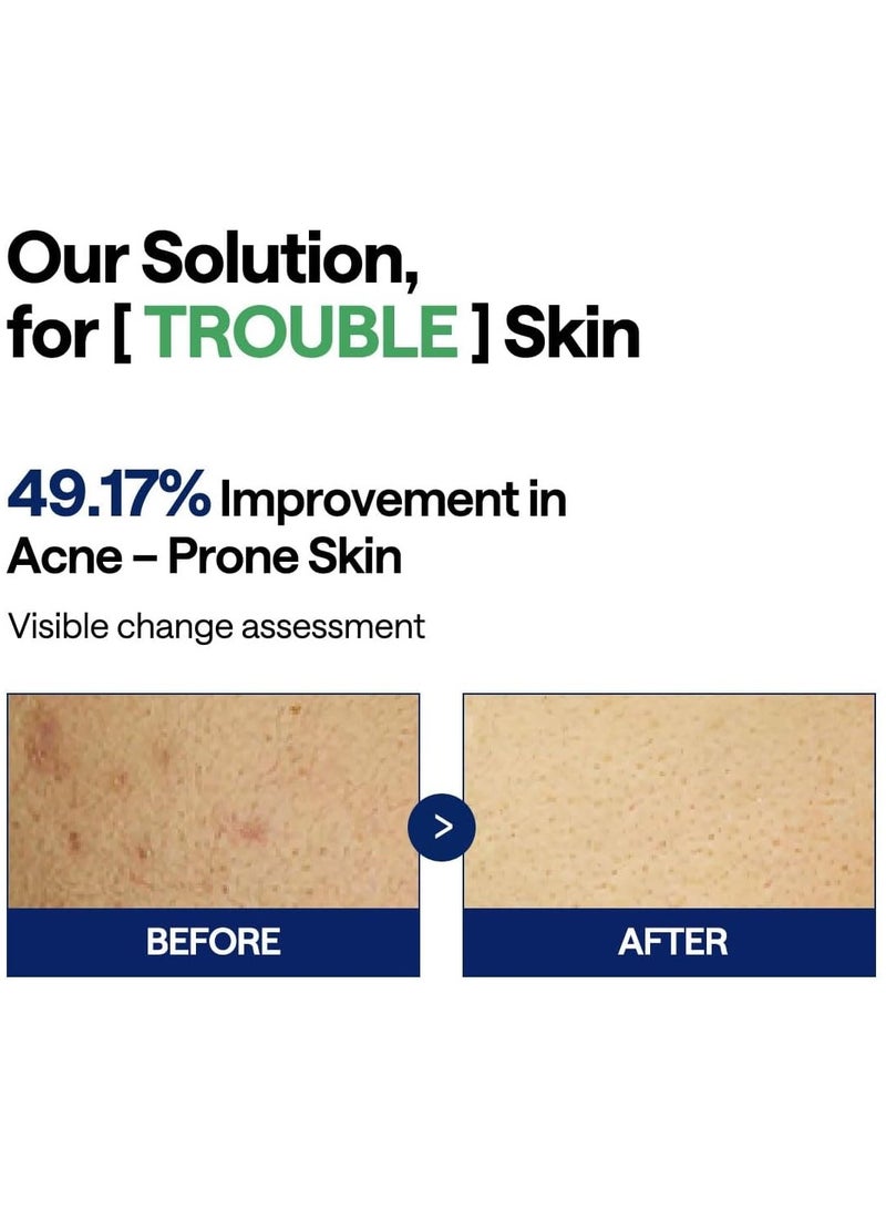 MEDIHEAL Teatree Trouble Pad | Square Cotton Facial Toner Pads With Tea Tree & Lactobacillus | Soothing Pads To Calm Sensitive & Acne Prone Skin-| Vegan Face Gauze Pads | 100 Pads  - Image 4