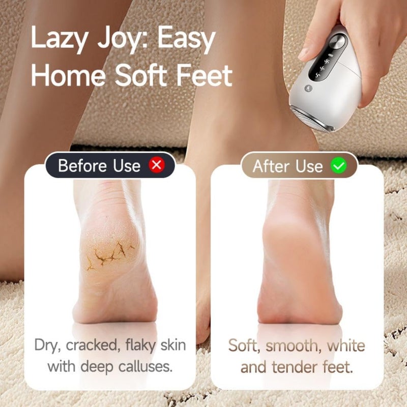 Cuorvag Electric Callus Remover for Feet, Rechargeable Electric Foot File & Foot Scrubber for Dead Skin, Dry Heels and Hard Skin, 3 Speeds, Dual Stainless Steel Heads, IPX6 Washable, Type-C - Image 5
