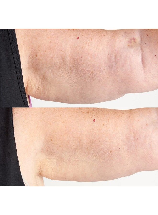 High Potency Classics Hyaluronic Intensive Body Therapy 6 Oz.